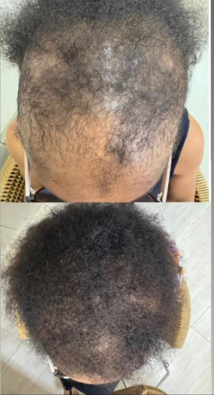 Antes e depois do tratamento capilar em cabelo crespo