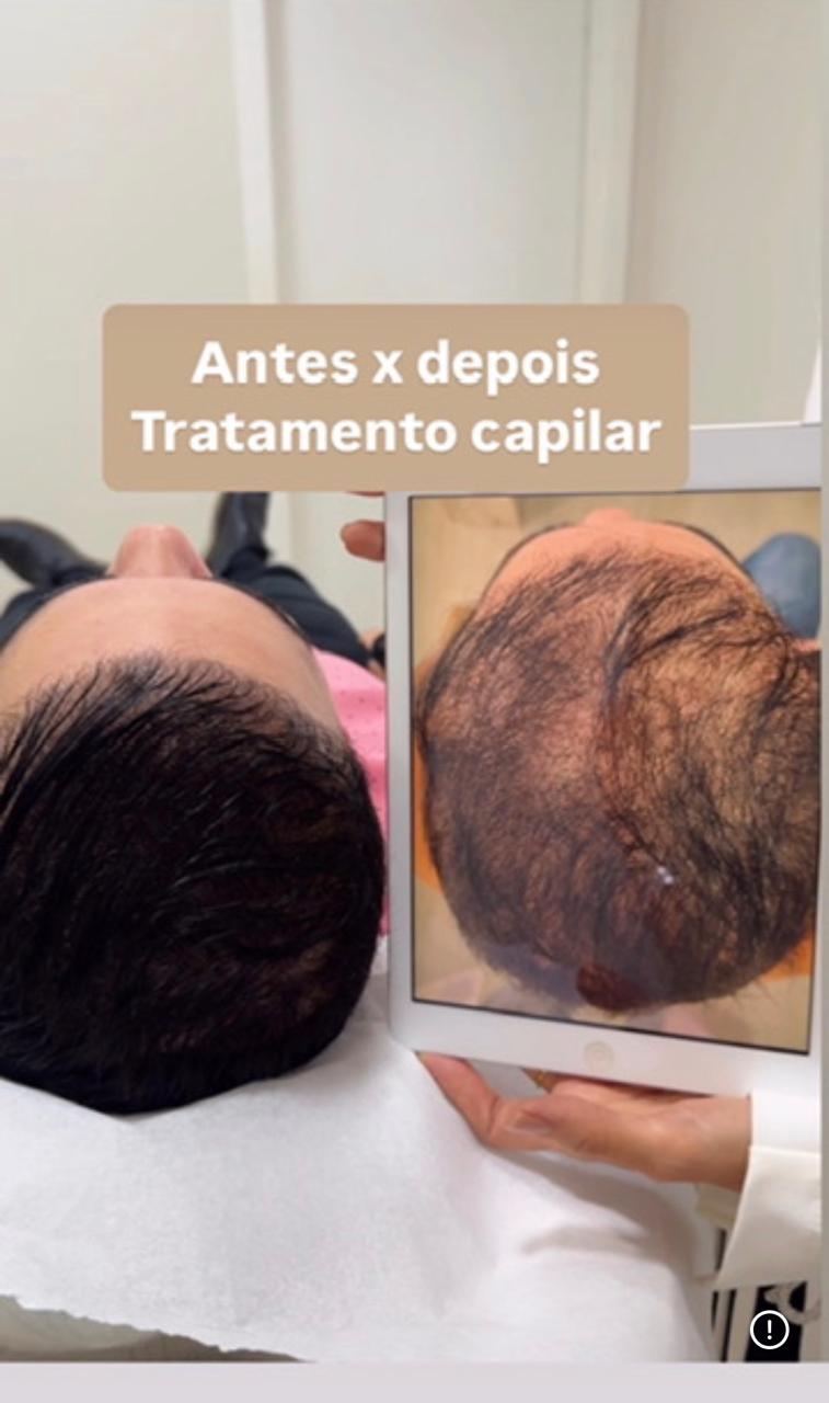 Comparativo antes e depois do tratamento capilar mostrado em tablet na clínica